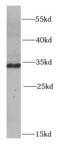 Pyrroline-5-Carboxylate Reductase 1 antibody, FNab06968, FineTest, Western Blot image 