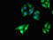 Kinase D Interacting Substrate 220 antibody, LS-C678435, Lifespan Biosciences, Immunofluorescence image 