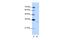 MTR3 antibody, GTX47230, GeneTex, Western Blot image 