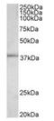 Fos Proto-Oncogene, AP-1 Transcription Factor Subunit antibody, orb12285, Biorbyt, Western Blot image 