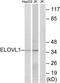 ELOVL Fatty Acid Elongase 1 antibody, TA315748, Origene, Western Blot image 