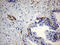 Ubiquitin thioesterase ZRANB1 antibody, M10897, Boster Biological Technology, Immunohistochemistry paraffin image 