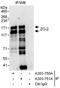 Tight Junction Protein 2 antibody, A303-750A, Bethyl Labs, Immunoprecipitation image 