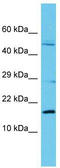 Chromosome 8 Open Reading Frame 44 antibody, TA330700, Origene, Western Blot image 