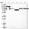 Protein Phosphatase 1 Regulatory Subunit 21 antibody, NBP1-86582, Novus Biologicals, Western Blot image 