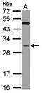Quinoid Dihydropteridine Reductase antibody, LS-C155233, Lifespan Biosciences, Western Blot image 