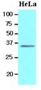 BRCA1/BRCA2-Containing Complex Subunit 3 antibody, LS-B3588, Lifespan Biosciences, Western Blot image 