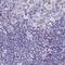 Napsin A Aspartic Peptidase antibody, PA5-60970, Invitrogen Antibodies, Immunohistochemistry frozen image 