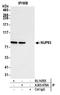 Nucleoporin 93 antibody, A303-979A, Bethyl Labs, Immunoprecipitation image 