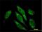 Aldehyde Dehydrogenase 16 Family Member A1 antibody, H00126133-B01P, Novus Biologicals, Immunofluorescence image 