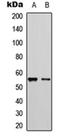 Cytochrome P450 Family 2 Subfamily D Member 6 antibody, orb315770, Biorbyt, Western Blot image 