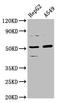Coproporphyrinogen Oxidase antibody, LS-C674957, Lifespan Biosciences, Western Blot image 