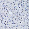 Baculoviral IAP Repeat Containing 7 antibody, A02577-1, Boster Biological Technology, Immunohistochemistry paraffin image 