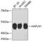 Hyaluronan And Proteoglycan Link Protein 1 antibody, 13-823, ProSci, Western Blot image 