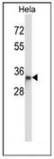 Dystrobrevin Binding Protein 1 antibody, AP51331PU-N, Origene, Western Blot image 
