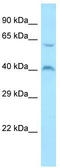 MORN Repeat Containing 1 antibody, TA334326, Origene, Western Blot image 