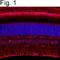 Retinaldehyde Binding Protein 1 antibody, MA1-813, Invitrogen Antibodies, Immunofluorescence image 