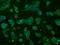 ATP Synthase F1 Subunit Beta antibody, GTX84843, GeneTex, Immunocytochemistry image 