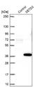SET Domain Containing 3, Actin Histidine Methyltransferase antibody, NBP1-88415, Novus Biologicals, Western Blot image 