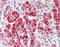 Clathrin Heavy Chain antibody, TA316635, Origene, Immunohistochemistry frozen image 