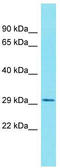 Glycoprotein Integral Membrane 1 antibody, TA333532, Origene, Western Blot image 