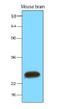 Synaptosome Associated Protein 25 antibody, AM09034PU-S, Origene, Western Blot image 