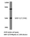 Mitochondrial Ribosomal Protein S27 antibody, LS-C177469, Lifespan Biosciences, Western Blot image 