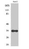 Cytochrome B5 Reductase 3 antibody, STJ92531, St John