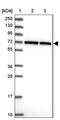 Coiled-Coil Domain Containing 112 antibody, PA5-60930, Invitrogen Antibodies, Western Blot image 