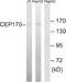 Centrosomal protein of 170 kDa antibody, A30606, Boster Biological Technology, Western Blot image 