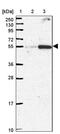 Family With Sequence Similarity 222 Member B antibody, PA5-62496, Invitrogen Antibodies, Western Blot image 