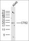 Cancer/Testis Antigen 62 antibody, orb182789, Biorbyt, Western Blot image 