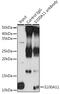 S100 Calcium Binding Protein A11 antibody, GTX33483, GeneTex, Immunoprecipitation image 