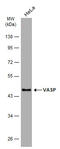Vasodilator Stimulated Phosphoprotein antibody, GTX634448, GeneTex, Western Blot image 