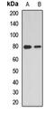 Segment polarity protein dishevelled homolog DVL-2 antibody, orb412633, Biorbyt, Western Blot image 