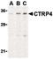 C1q And TNF Related 4 antibody, PA5-20151, Invitrogen Antibodies, Western Blot image 