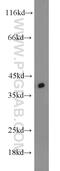 DnaJ Heat Shock Protein Family (Hsp40) Member A3 antibody, 11088-1-AP, Proteintech Group, Western Blot image 
