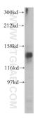 Structural maintenance of chromosomes protein 6 antibody, 14465-1-AP, Proteintech Group, Western Blot image 