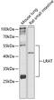 Lecithin retinol acyltransferase antibody, 14-873, ProSci, Western Blot image 