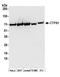 CTP Synthase 1 antibody, A304-543A, Bethyl Labs, Western Blot image 