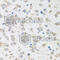 Ribosomal Protein Lateral Stalk Subunit P1 antibody, A6725, ABclonal Technology, Immunohistochemistry paraffin image 