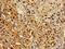 Regucalcin antibody, CSB-PA623001LA01HU, Cusabio, Immunohistochemistry paraffin image 