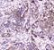 Succinate Dehydrogenase Complex Iron Sulfur Subunit B antibody, A01090, Boster Biological Technology, Immunohistochemistry frozen image 
