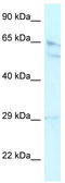 RB Binding Protein 5, Histone Lysine Methyltransferase Complex Subunit antibody, TA335727, Origene, Western Blot image 