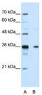 Nanos C2HC-Type Zinc Finger 1 antibody, TA344041, Origene, Western Blot image 