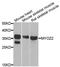 Myozenin 2 antibody, A6468, ABclonal Technology, Western Blot image 