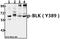 BLK Proto-Oncogene, Src Family Tyrosine Kinase antibody, A01539Y389, Boster Biological Technology, Western Blot image 