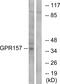 G Protein-Coupled Receptor 157 antibody, GTX87984, GeneTex, Western Blot image 