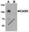 CASK antibody, 6921, ProSci Inc, Western Blot image 