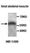 Sterol O-acyltransferase 1 antibody, orb76997, Biorbyt, Western Blot image 